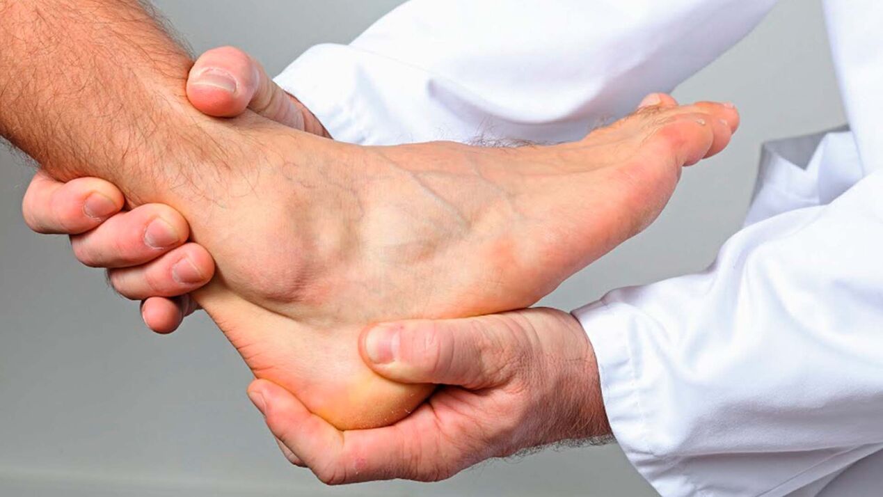 osteoarthritis of the ankle joint
