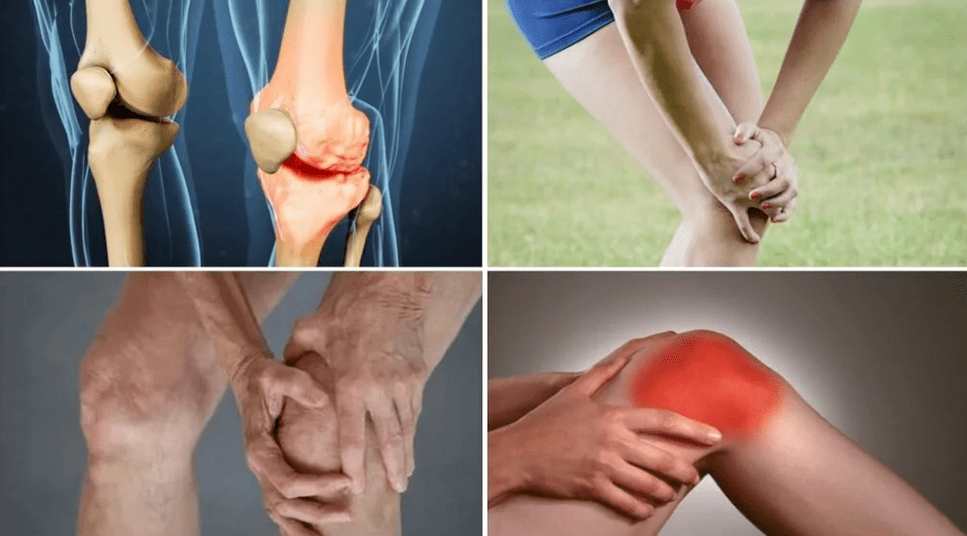 Symptoms of osteoarthritis