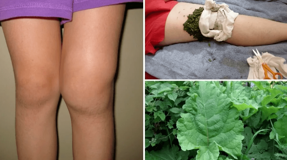 Treatment with popular methods