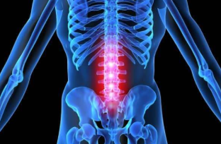The vertebral osteochondrosis